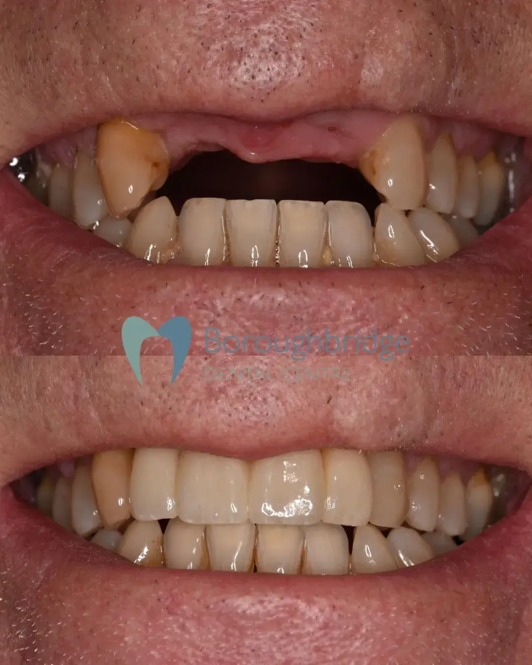 Boroughbridge Dental Practice | Dental Practice Ripon | Dentist North Yorkshire