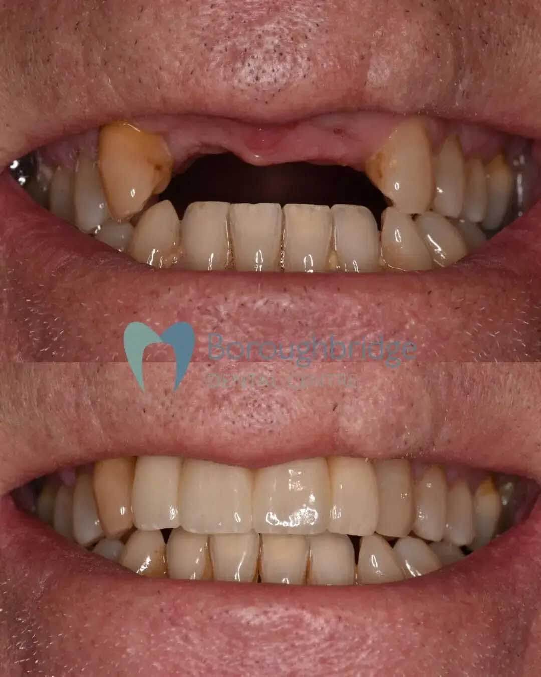 Boroughbridge Dental Practice | Dental Practice Ripon | Dentist North Yorkshire