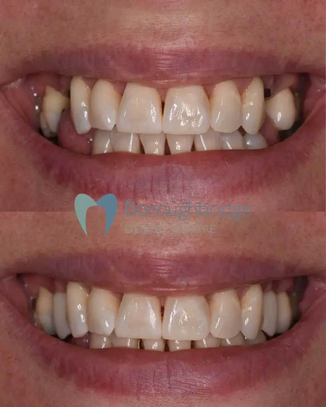Boroughbridge Dental Practice | Dental Practice Ripon | Dentist North Yorkshire