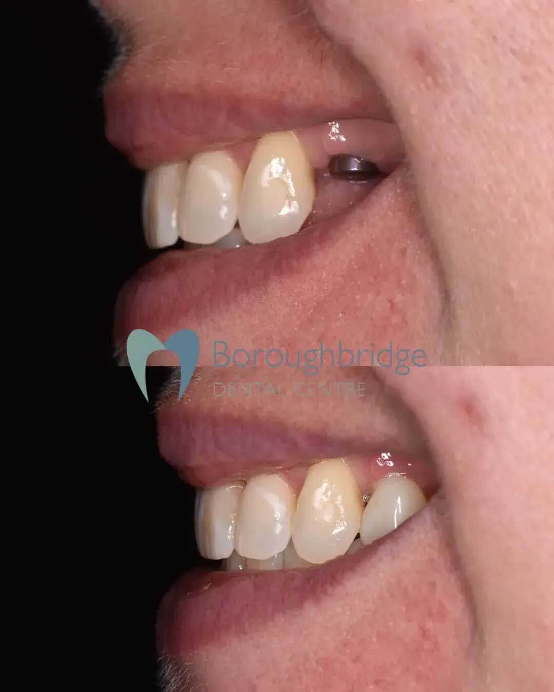 Boroughbridge Dental Practice | Dental Practice Ripon | Dentist North Yorkshire