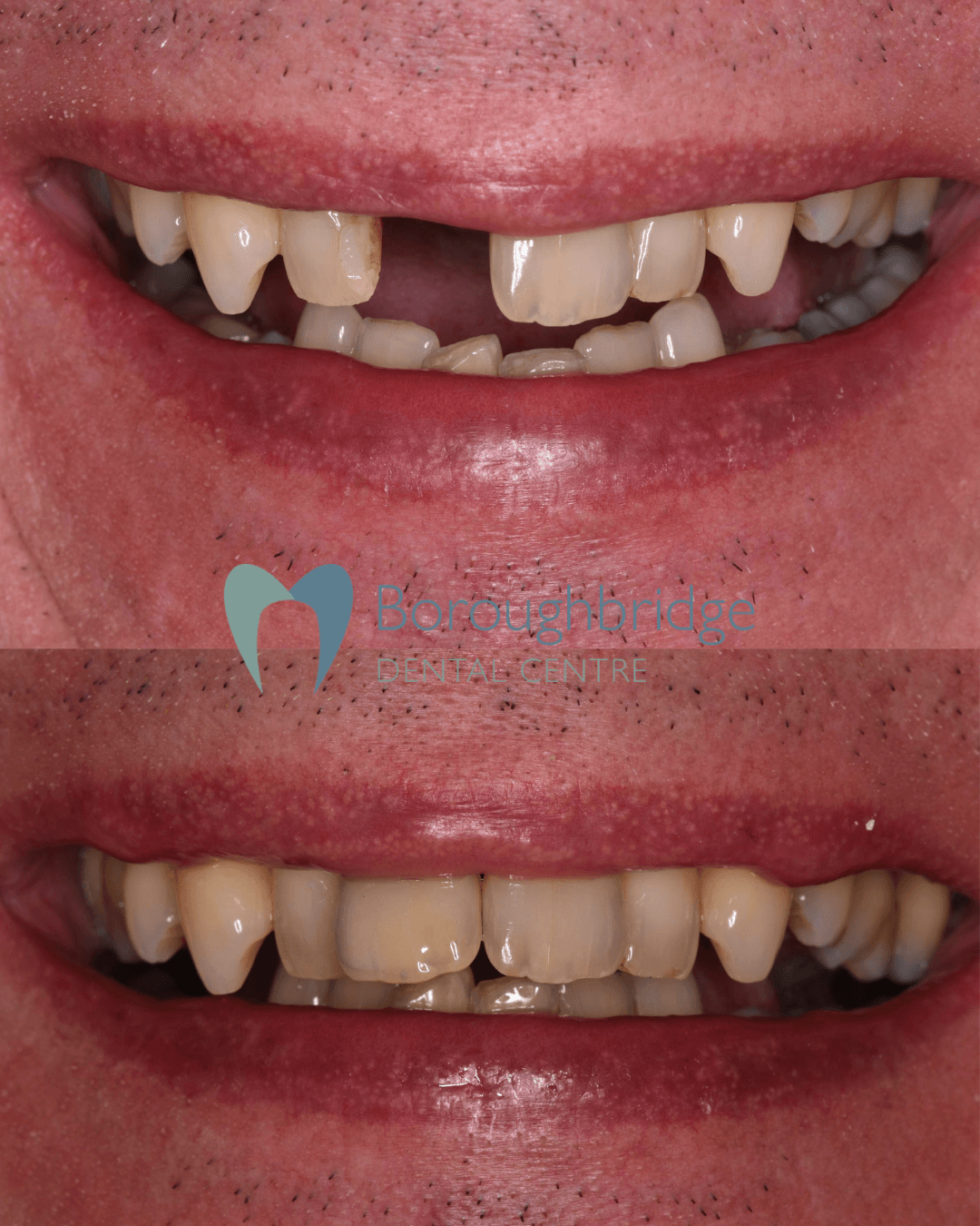 Boroughbridge Dental Practice | Dental Practice Ripon | Dentist North Yorkshire