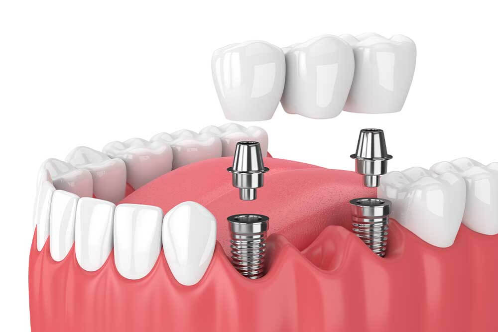 Boroughbridge Dental Practice | Dental Practice Ripon | Dentist North Yorkshire